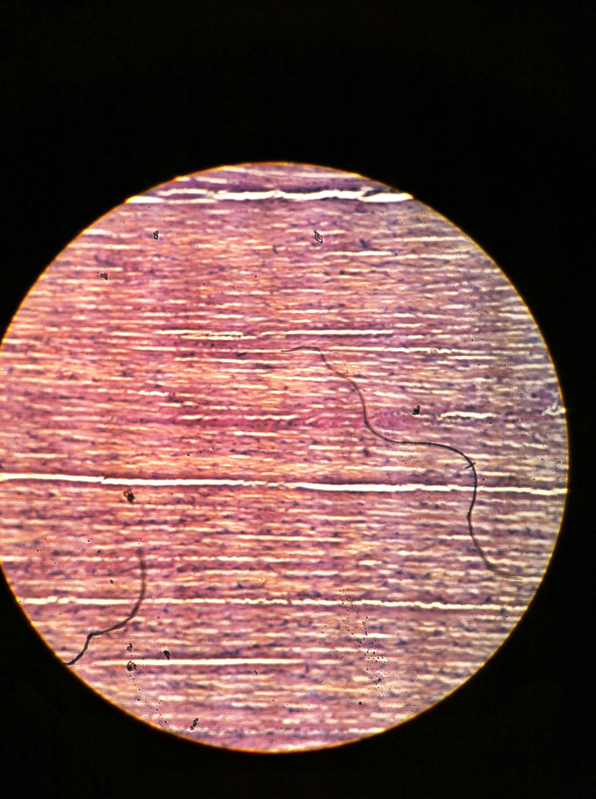 dense regular (white fibrous tissue), Total Mag: 100X