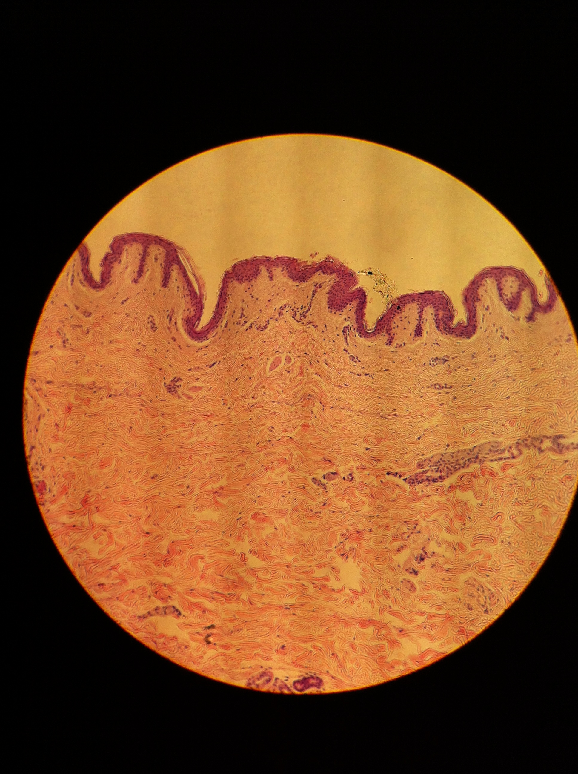 dense irregular (dermis of skin), Total Mag: 100X