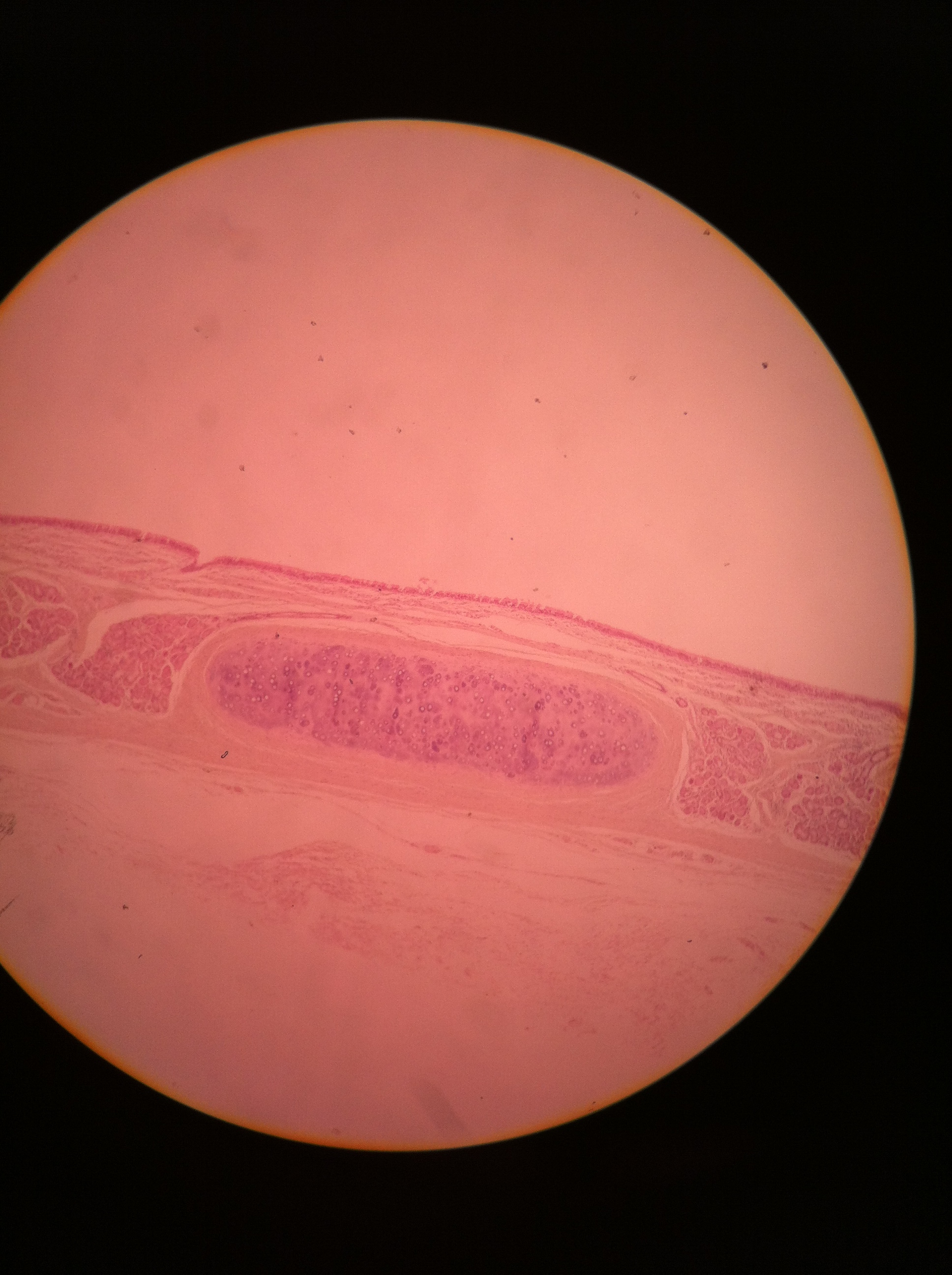 Hyaline cartilage (trachea), 100X