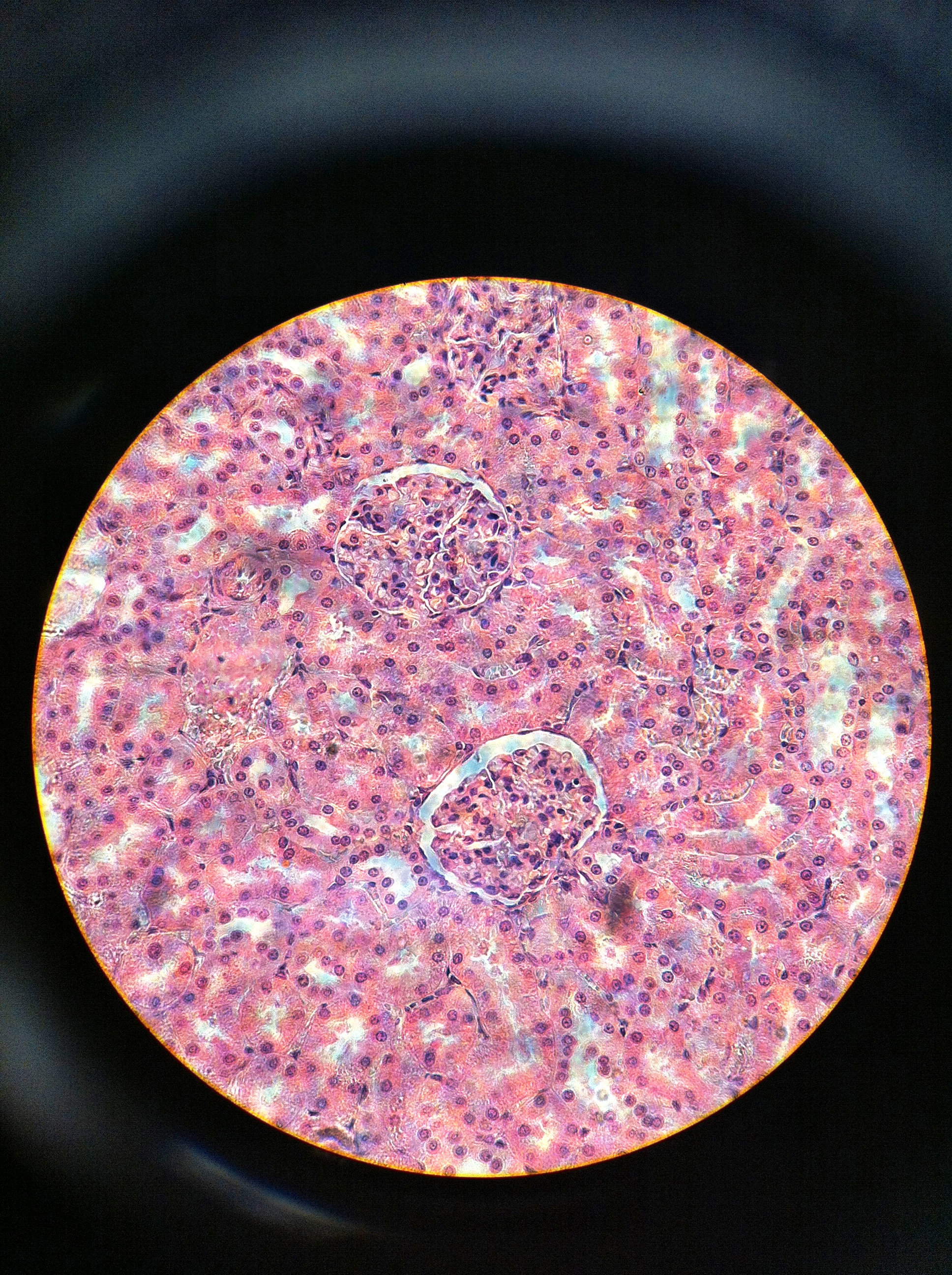 Renal Corpuscle 400X