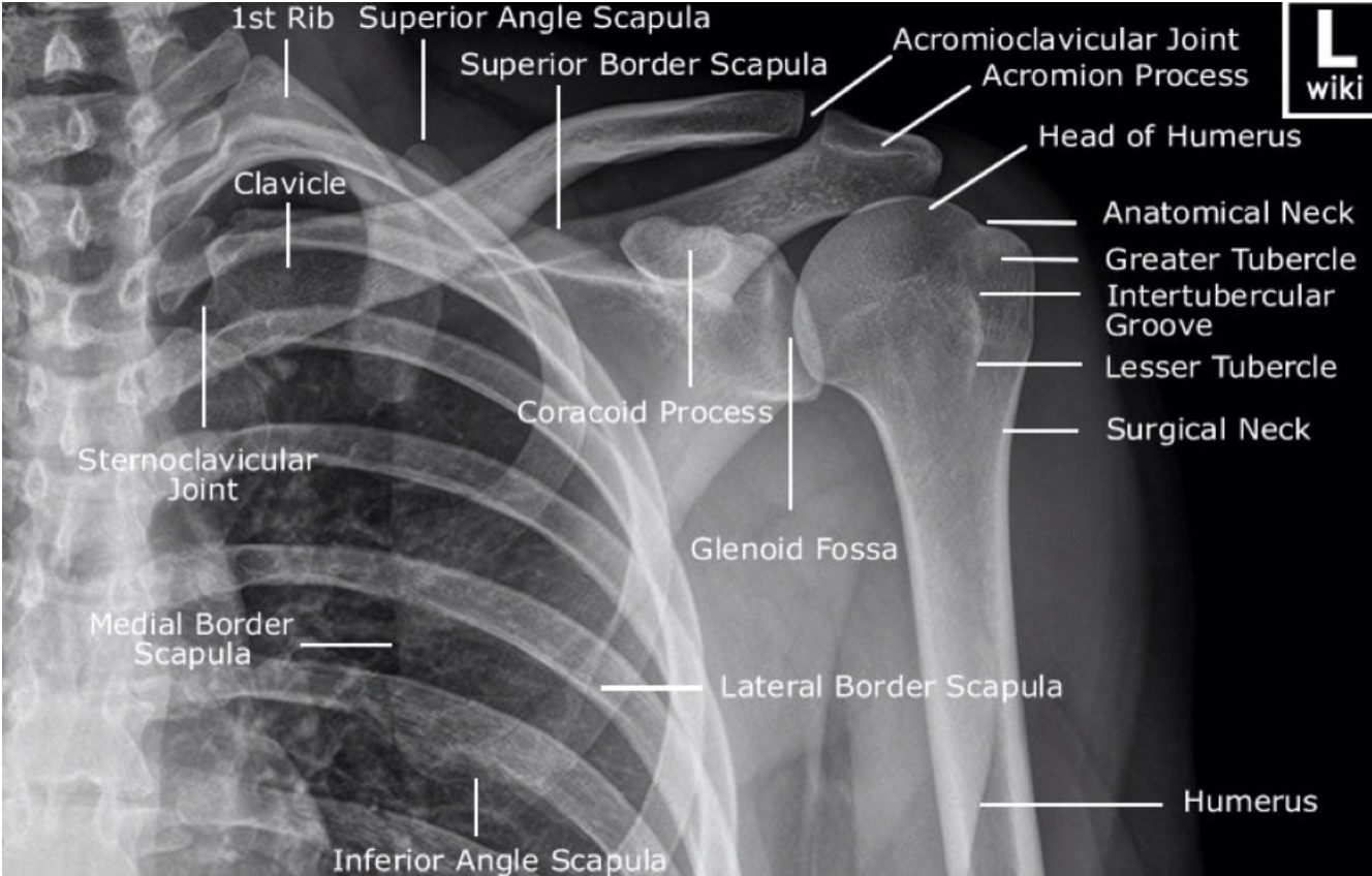 Intertubercular Groove Xray