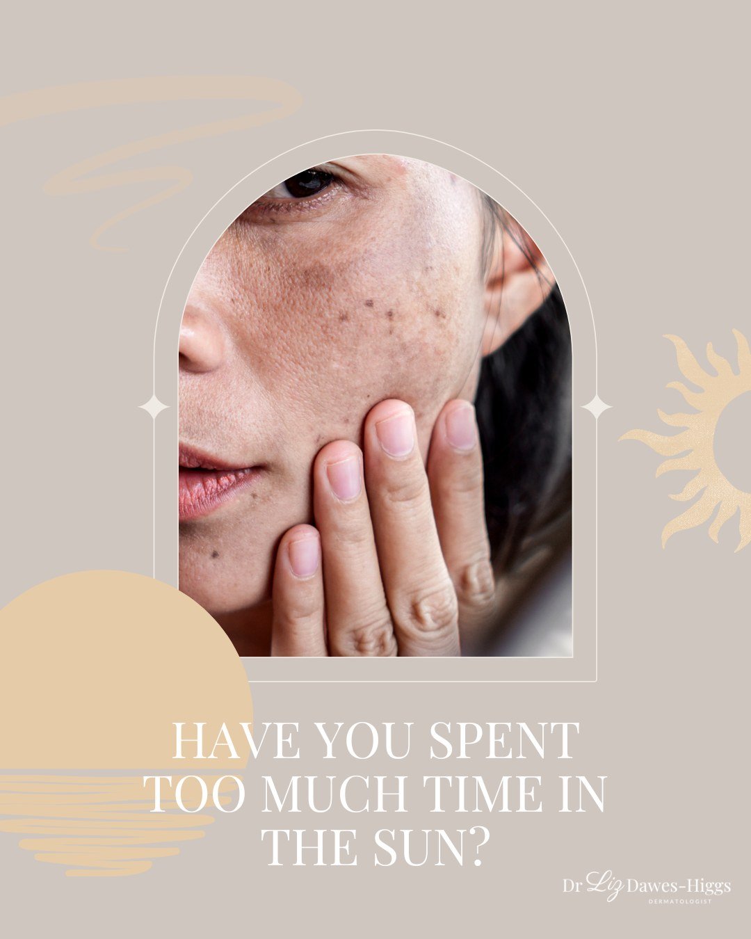 🌞 Have You Spent Too Much Time in the Sun? 🌞
Australia&rsquo;s gorgeous weather at them moment makes it tempting to spend all day out in the sun&mdash;but how much is too much? Over time, excessive sun exposure can lead to sun-damaged skin, a commo