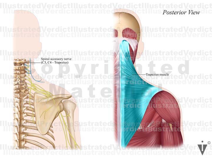 Stock Neck: Spinal Accessory Nerve — Illustrated Verdict