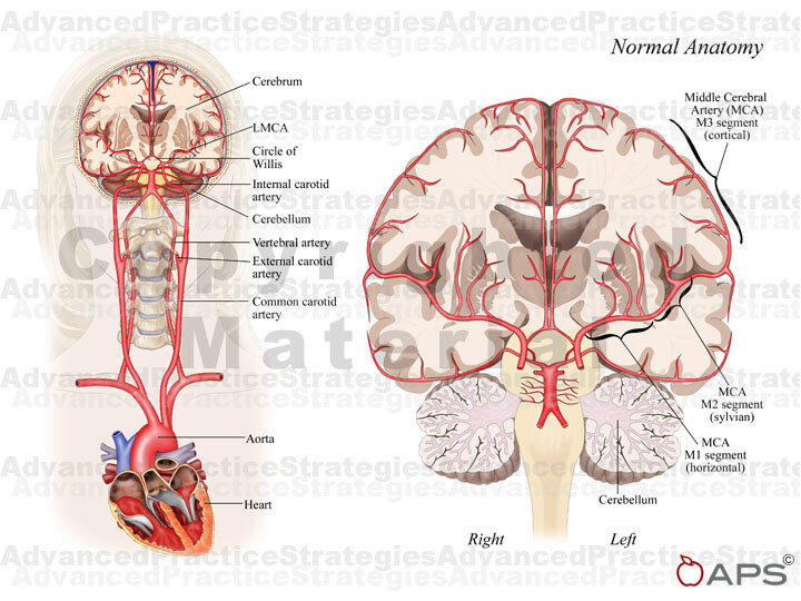 Stock Brain: Normal Anatomy Vasculature — Illustrated Verdict