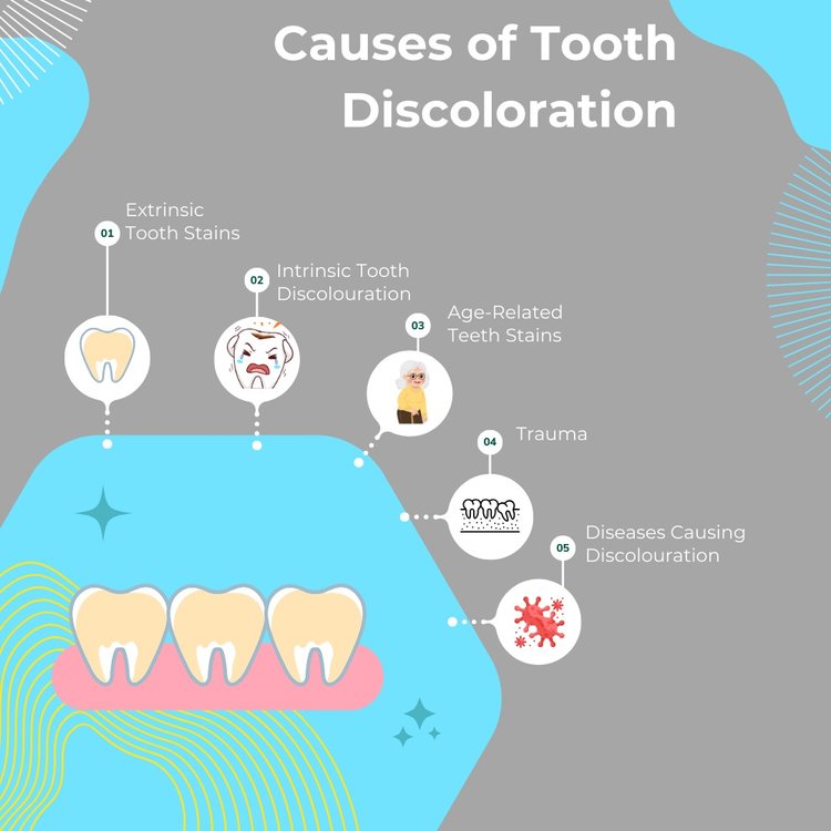 Tooth Discolouration: Types, Causes, and Prevention Methods - KWC Dental