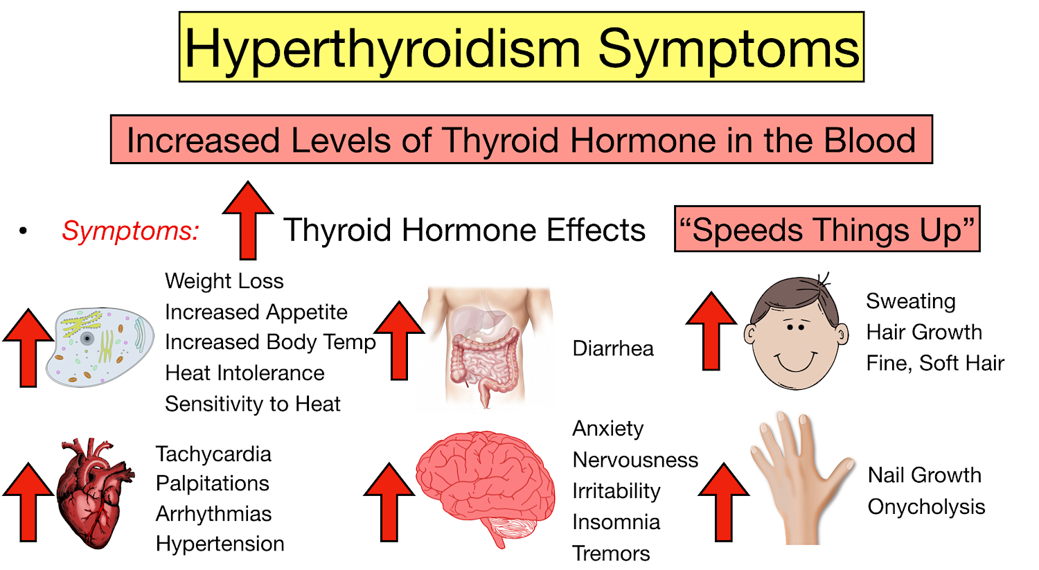 Hypothyroidism Hyperthyroidism: Differences And Symptoms, 50% OFF