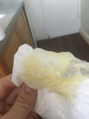 Yellow Cervical Mucus