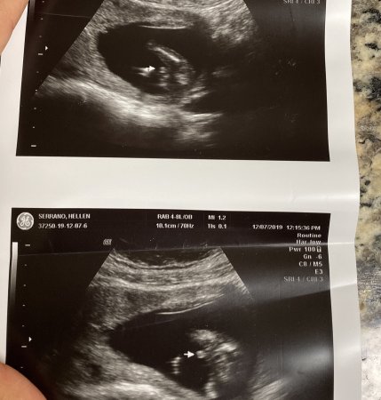 I WANT TO SEE EVERYONES GENDER PREDICTIONS/CONFIRMATION ULTRASOUNDS ...