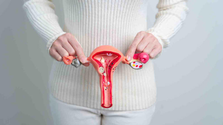 Uterine fibroids: Symptoms, causes, and more about this condition