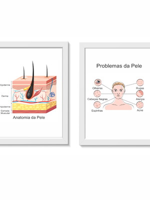 Kit 2 quadros decorativos problemas da pele dermatologia