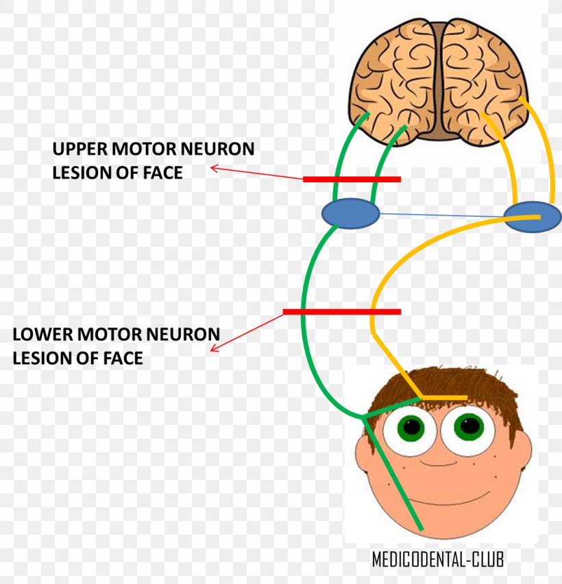 Lower Motor Neuron Lesion Facial Nerve Upper Motor Neuron Lesion, PNG, 1060x1102px, Watercolor, Cartoon, Flower, Frame, Heart Download Free