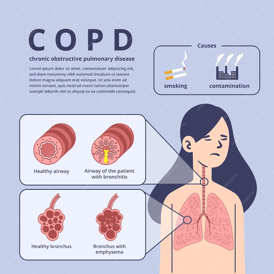 Premium Vector | Flat-hand drawn copd infographic