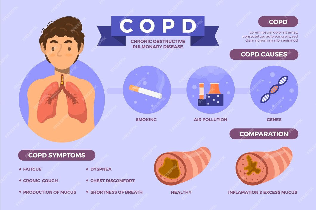 Free Vector | Flat-hand drawn copd infographic