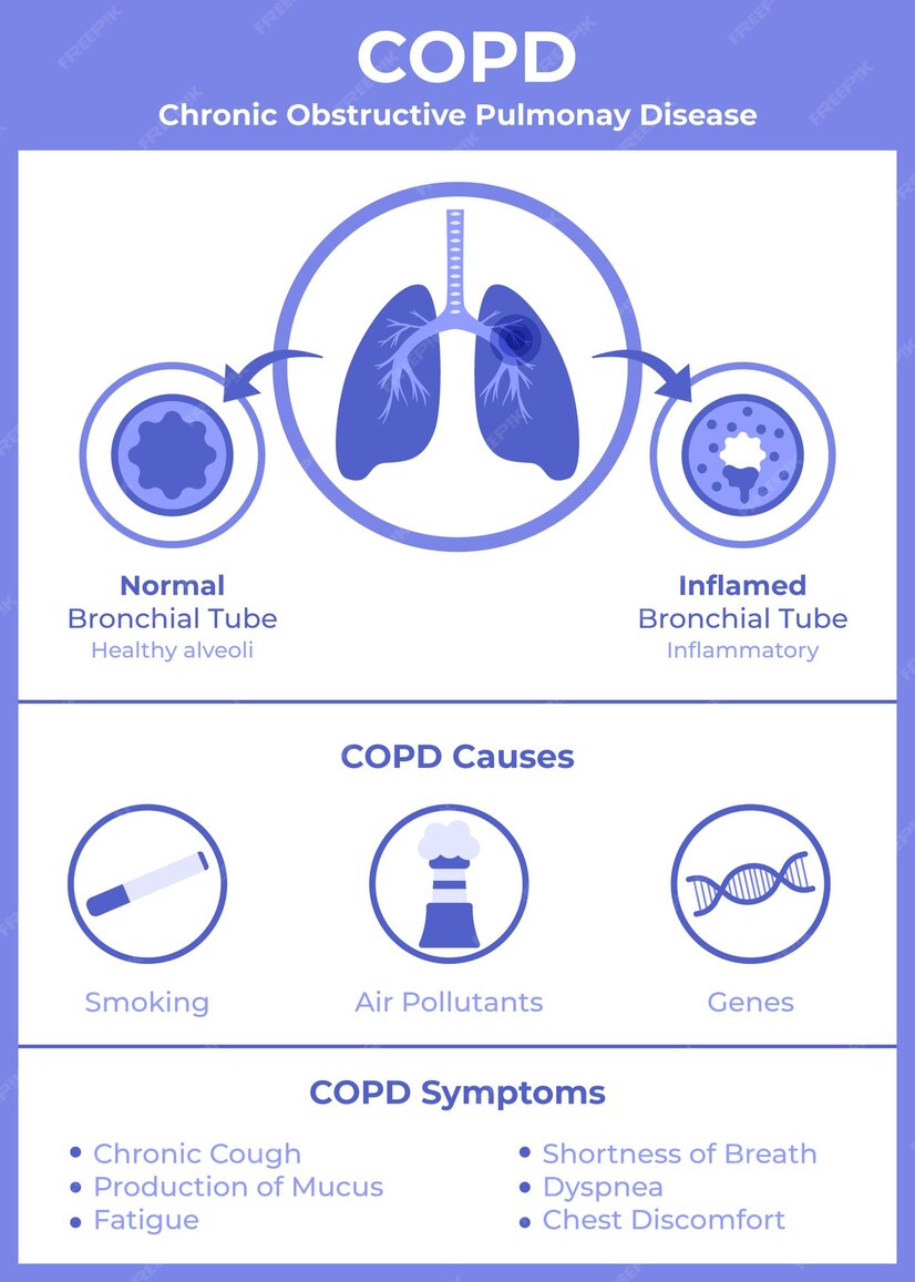 Free Vector | Flat-hand drawn copd infographic