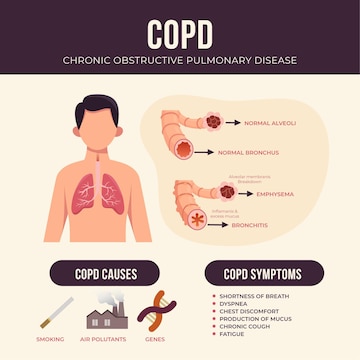 Premium Vector | Flat-hand drawn copd infographic