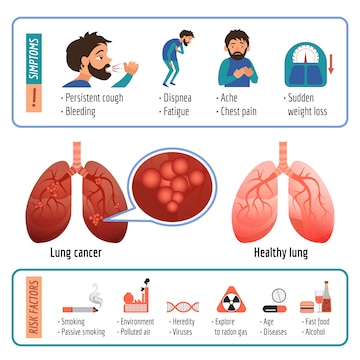 Premium Vector | Lung infographic. cartoon of lung vector infographic