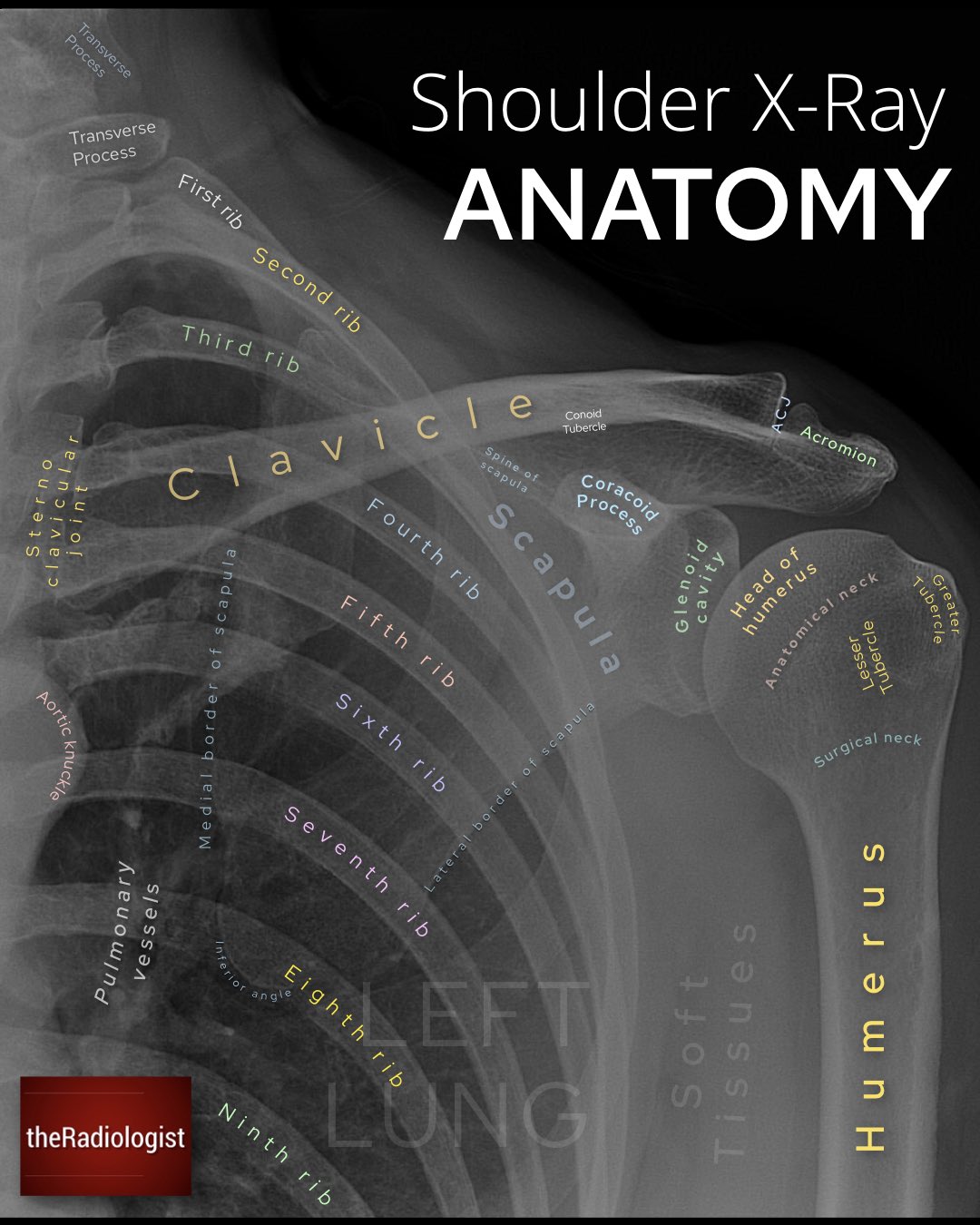 Shoulder Anatomy Labeled