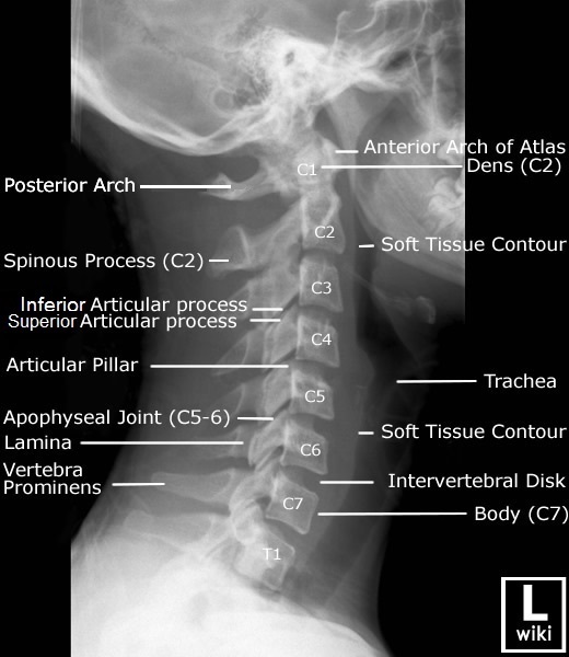 Cervical Vertebrae Labeled