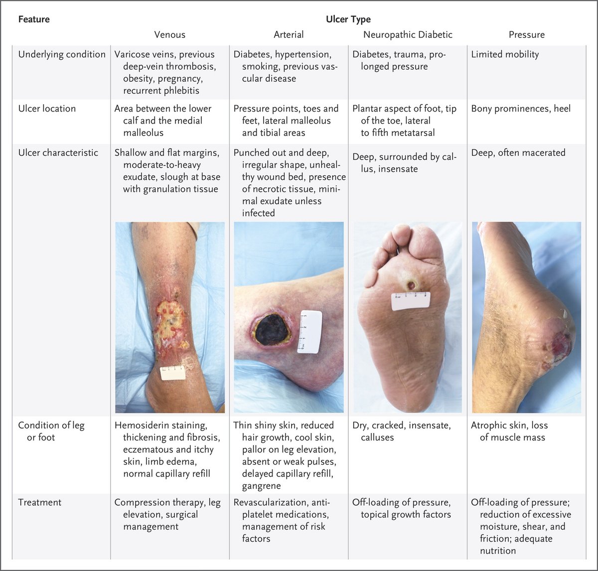 Ppt The Difference Between Venous And Arterial Ulcers Powerpoint ...