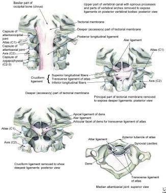 Cervical Spine Sprain/Strain Injuries: Practice Essentials ...