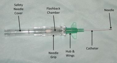 Intravenous Catheter Types