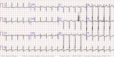 What are the possible presentations of heart failure on ...