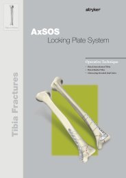 AxSOS Distal Tibia Alternating treaded shaft holes Operative - Stryker