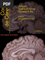 Cortes de Cerebro