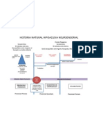 Hipoacusia Neurosensorial