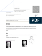 Derivacion Ventriculoperitoneal