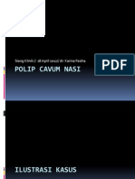 Polip Cavum Nasi