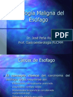 Cáncer de Esófago