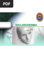 ESCLERODERMIA