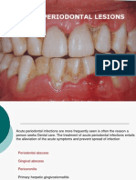 Acute Infections