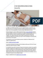 Tratamiento de Radiofrecuencia para Eliminar La Celulitis