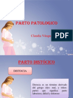 Parto Patologico