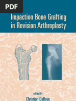 Impaction Bone Grafting in Revision Arthroplasty - C. Delloye, G. Bannister (Eds.) (Marcel Dekker, 2004) WW