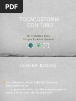 Toracostomía Con Tubo de Tórax