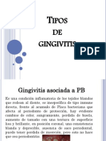 Tipos de Gingivitis D