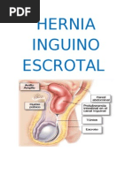 Seminario - Hernia Inguinoescrotal