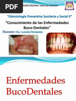 Enfermedades Bucales