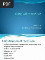 Gingival Recession