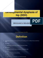 Development Dysplasia of Hip