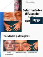 LE, Dermatomiosistis, Esclerodermia