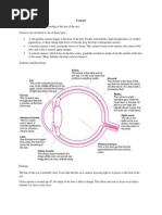 Cataract