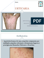 Urticaria