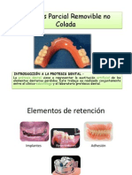 Prótesis Parcial Removible No Colada