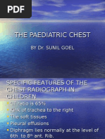 Paediatric Chest Radiology