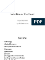 Infection of The Hand: Alyaa Farhan Syahida Hanim