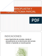 Turbinoplastia y Turbinectomia Parcial